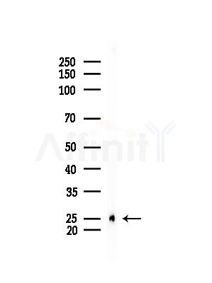 Peroxiredoxin 2 Antibody - Western blot analysis of lysates from Mouse testis, using Peroxiredoxin 2 Antibody at 1/1000 dilution.