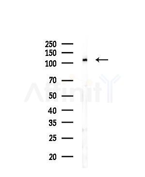 BUB1 Antibody - Western blot analysis of lysates from Mouse testis, using BUB1 Antibody at 1/1000 dilution.