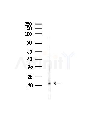 GPX4 Antibody - Western blot analysis of lysates from COLO205 cells(UV,30min treatment), using GPX4 Antibody at 1/1000 dilution.