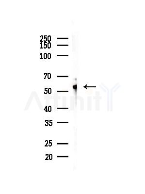 U2AF2 Antibody - Western blot analysis of lysates from COLO205 cells(heat-shock,45min treatment), using U2AF2 Antibody at 1/1000 dilution.