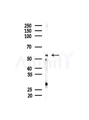 U2AF2 Antibody - Western blot analysis of lysates from MDA-MB-231 cells(heat-shock,45min treatment), using U2AF2 Antibody at 1/1000 dilution.