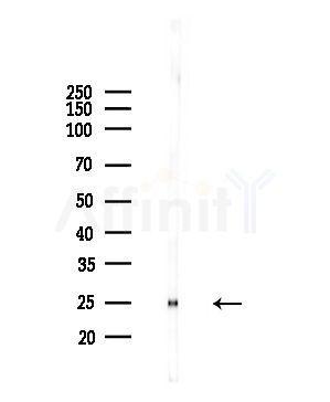 PSMD10 Antibody - Western blot analysis of lysates from Hela cells(UV,30min treatment), using PSMD10 Antibody at 1/1000 dilution.