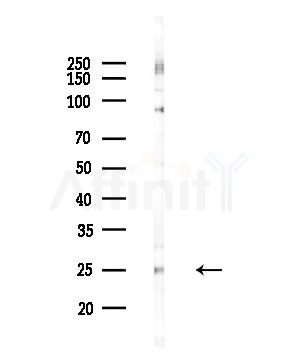 PSMD10 Antibody - Western blot analysis of lysates from COLO205 cells(UV,30min treatment), using PSMD10 Antibody at 1/1000 dilution.