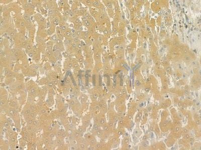 TCP1 alpha Antibody - DF6714 at 1/100 staining human normal liver tissue by IHC-P.
