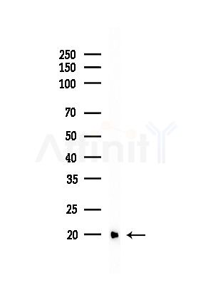 UBE2D1 Antibody - Western blot analysis of lysates from HUVEC cells(starvation,24h treatment), using UBE2D1 Antibody at 1/1000 dilution.