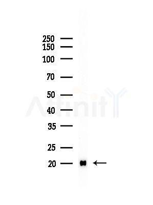 UBE2D1 Antibody - Western blot analysis of lysates from Hela cells(heat-shock,45min treatment), using UBE2D1 Antibody at 1/1000 dilution.