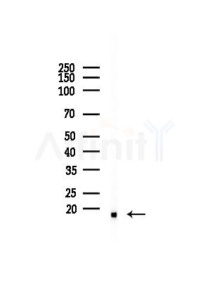 UBE2D1 Antibody - Western blot analysis of lysates from Rat brain, using UBE2D1 Antibody at 1/1000 dilution.