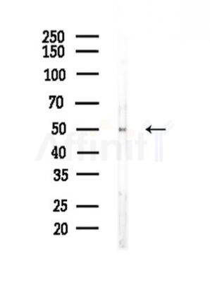 TRIM21 Antibody - Western blot analysis of lysates from COLO205 cells, using TRIM21 Antibody at 1/1000 dilution.