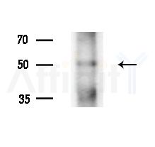 TAPBP Antibody - Western blot analysis of lysates from HepG2 cells(LPS, 4h treatment), using TAPBP Antibody at 1/1000 dilution.