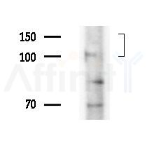 PTP  alpha Antibody - Western blot analysis of extracts from HepG2 cells(LPS, 4h treatment), using PTP  alpha Antibody at 1/1000 dilution.