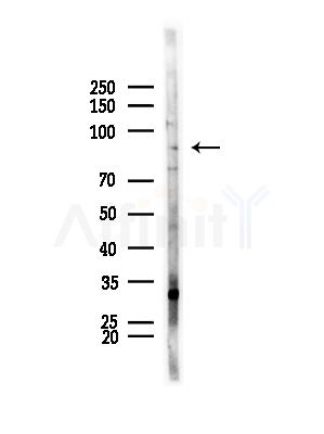 PTP  alpha Antibody - Western blot analysis of lysates from HepG2 cells(LPS, 4h treatment), using PTP  alpha Antibody at 1/1000 dilution.