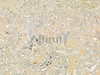 PTP  alpha Antibody - DF6729 at 1/100 staining human normal lung tissue by IHC-P.