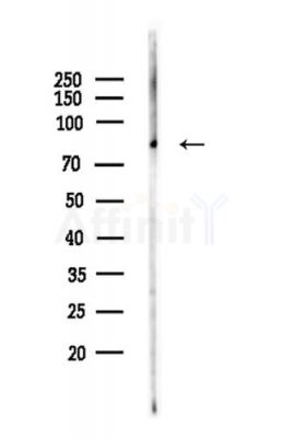 ACVR2A Antibody - Western blot analysis of lysates from LoVo cells(heat-shock,45min treatment), using ACVR2A Antibody at 1/1000 dilution.