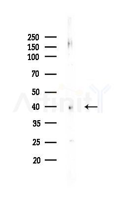 HSD17B2 Antibody - Western blot analysis of lysates from MCF7 cells(heat-shock,45min treatment), using HSD17B2 Antibody at 1/1000 dilution.
