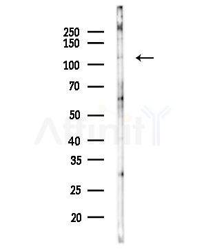 IPO5 Antibody - Western blot analysis of lysates from COLO205 cells(heat-shock,45min treatment), using IPO5 Antibody at 1/1000 dilution.