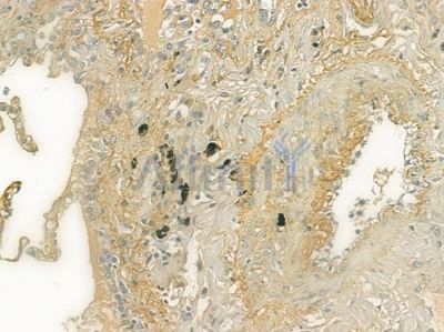 APCS Antibody - DF6742 at 1/100 staining human normal lung tissue by IHC-P.