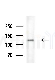 SMARCA5 Antibody - Western blot analysis of extracts from various samples, using SMARCA5 Antibody at 1/1000 dilution.