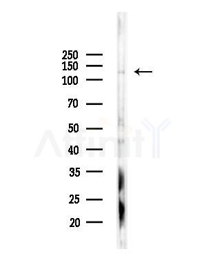 SMARCA5 Antibody - Western blot analysis of lysates from Hela cells(LPS,4h treatment), using SMARCA5 Antibody at 1/1000 dilution.