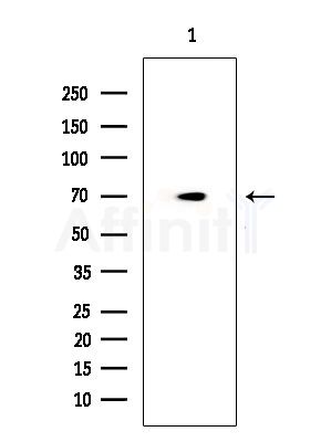 AOC3 Antibody - Western blot analysis of extracts from COLO205 cells, using AOC3 Antibody at 1/1000 dilution.