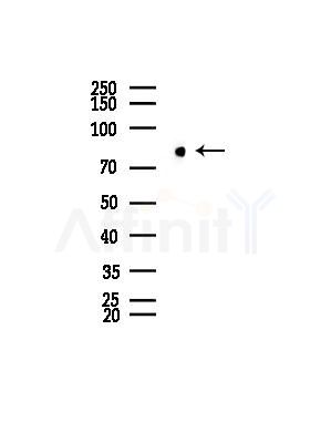 AOC3 Antibody - Western blot analysis of lysates from COLO205 cells, using AOC3 Antibody at 1/1000 dilution.