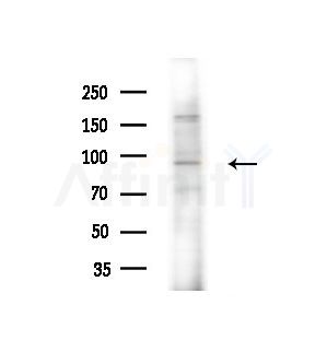 IFI16 Antibody - Western blot analysis of extracts from B16F10-LUC cells(heat-shock,45min treatment), using IFI16 Antibody at 1/1000 dilution.