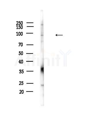 IFI16 Antibody - Western blot analysis of lysates from B16F10-LUC cells(heat-shock,45min treatment), using IFI16 Antibody at 1/1000 dilution.