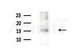 EIF5A1 Antibody - Western blot analysis of extracts from B16F10-LUC cells(heat-shock,45min treatment), using EIF5A1 Antibody at 1/1000 dilution.