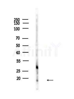 EIF5A1 Antibody - Western blot analysis of lysates from B16F10-LUC cells(heat-shock,45min treatment), using EIF5A1 Antibody at 1/1000 dilution.