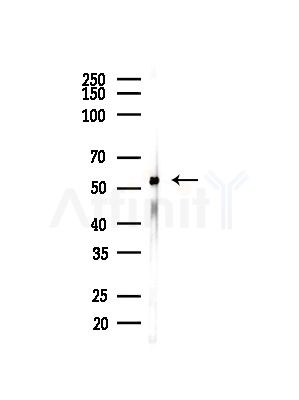 KPNA4 Antibody - Western blot analysis of lysates from COLO205 cells(heat-shock,45min treatment), using KPNA4 Antibody at 1/1000 dilution.