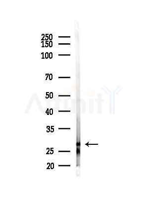 CD99 Antibody - Western blot analysis of lysates from B16F10-LUC cells(starvation,24h treatment), using CD99 Antibody at 1/1000 dilution.