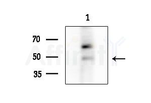CSF2RA Antibody - Western blot analysis of extracts from EC304 cells, using CSF2RA Antibody at 1/1000 dilution.