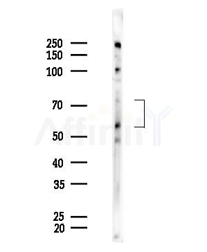 CSF2RA Antibody - Western blot analysis of lysates from EC304 cells, using CSF2RA Antibody at 1/1000 dilution.