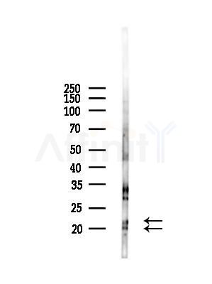 KLRD1 Antibody - Western blot analysis of lysates from Mouse liver, using KLRD1 Antibody at 1/1000 dilution.
