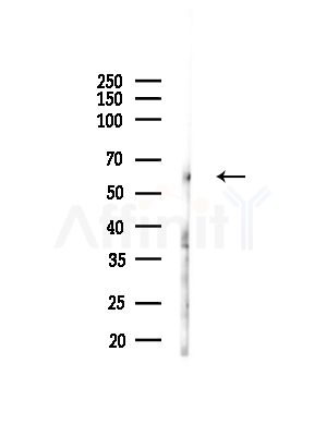CD33 Antibody - Western blot analysis of lysates from Hela cells(starvation,24h treatment), using CD33 Antibody at 1/1000 dilution.