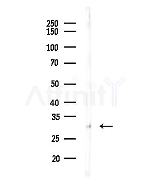 CTLA4 Antibody - Western blot analysis of lysates from COLO205 cells(heat-shock,45min treatment), using CTLA4 Antibody at 1/1000 dilution.