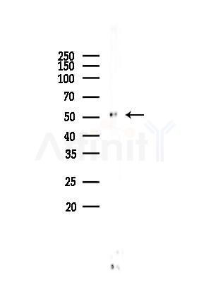 EPHX1 Antibody - Western blot analysis of lysates from HUVEC cells, using EPHX1 Antibody at 1/1000 dilution.