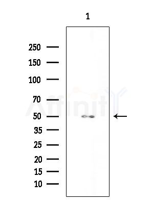 Hck Antibody - Western blot analysis of extracts from HepG2 cells(UV 30min treatment), using Hck Antibody at 1/1000 dilution.