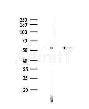 Hck Antibody - Western blot analysis of lysates from HepG2 cells(UV,30min treatment), using Hck Antibody at 1/1000 dilution.