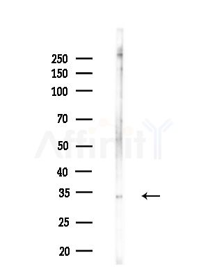 p40 phox Antibody - Western blot analysis of lysates from B16F10-LUC cells(LPS,4h treatment), using p40 phox Antibody at 1/1000 dilution.
