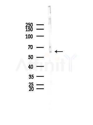 PDE1B Antibody - Western blot analysis of lysates from COLO205 cells, using PDE1B Antibody at 1/1000 dilution.