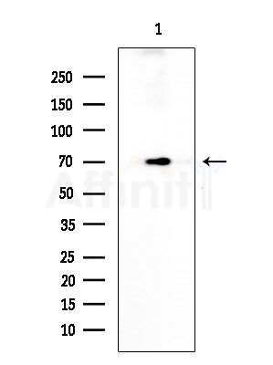 PKC epsilon Antibody - Western blot analysis of extracts from Rat testis, using PKC epsilon Antibody at 1/1000 dilution.