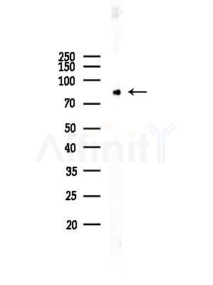 PKC epsilon Antibody - Western blot analysis of lysates from Rat testis, using PKC epsilon Antibody at 1/1000 dilution.