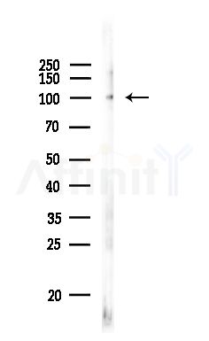 Retinoblastoma Antibody - Western blot analysis of lysates from LoVo cells(heat-shock,45min treatment), using Retinoblastoma Antibody at 1/1000 dilution.