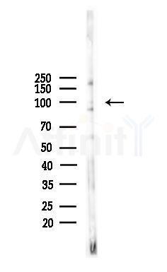 Retinoblastoma Antibody - Western blot analysis of lysates from Mouse brain, using Retinoblastoma Antibody at 1/1000 dilution.