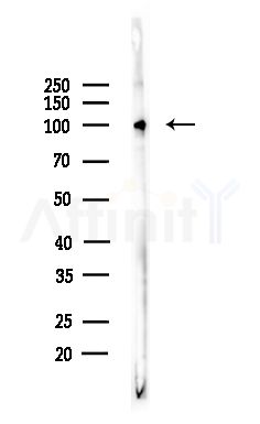 Retinoblastoma Antibody - Western blot analysis of lysates from Hela cells(LPS,4h treatment), using Retinoblastoma Antibody at 1/1000 dilution.