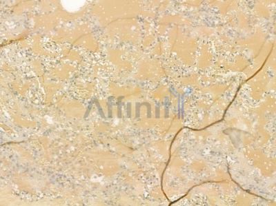 VEGFB Antibody - DF6855 at 1/100 staining human normal lung tissue by IHC-P.