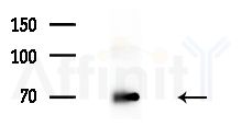 Zyxin Antibody - Western blot analysis of extracts from Mouse brain, using Zyxin Antibody at 1/1000 dilution.