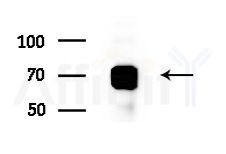 Zyxin Antibody - Western blot analysis of extracts from HepG2 cells(starvation treatment), using Zyxin Antibody at 1/1000 dilution.