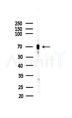 Zyxin Antibody - Western blot analysis of lysates from HepG2 cells(starvation,24h treatment), using Zyxin Antibody at 1/1000 dilution.