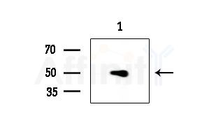 TNFSF10 Antibody - Western blot analysis of extracts from HepG2 cells(UV 30min treatment), using TNFSF10 Antibody at 1/1000 dilution.